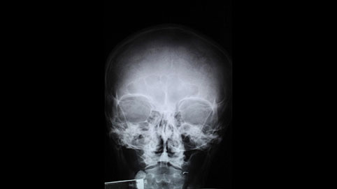 TROLIK, Davor Mezak, Danko, Friščić, Frane Rogić, instalacija, galerija Bačva, 2016.