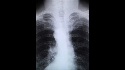 TROLIK, Davor Mezak, Danko, Friščić, Frane Rogić, instalacija, galerija Bačva, 2016.